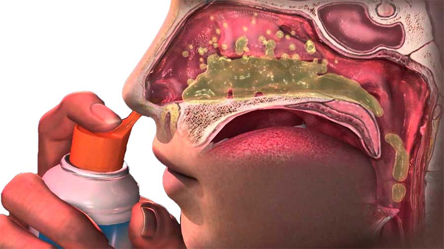 beneficios-da-irrigação-nasal-saude-bem-estar-e-beleza