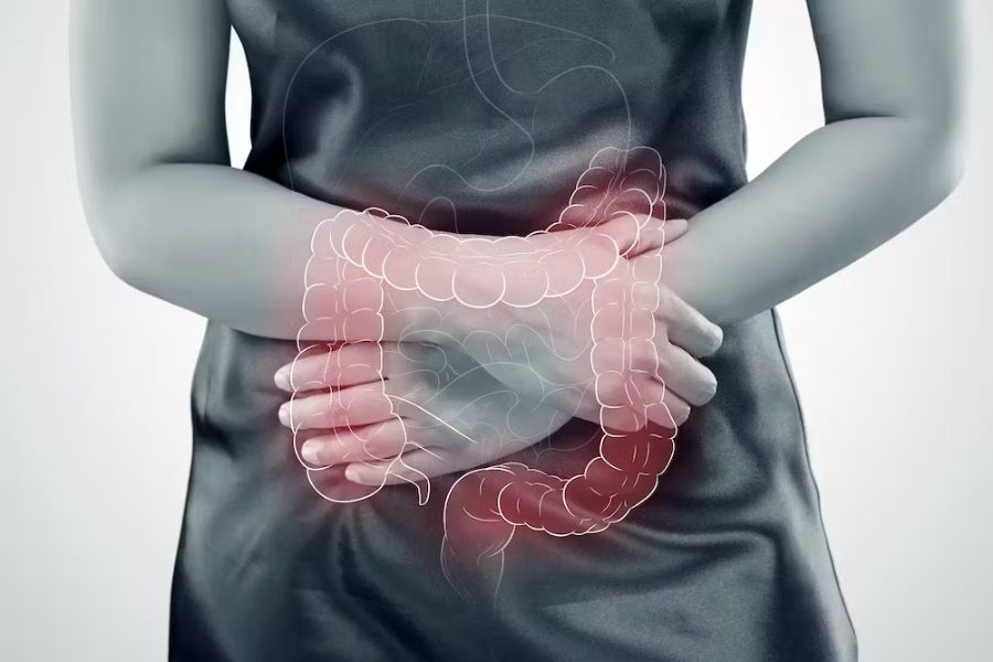 câncer-de-intestino-saude-bem-estar-e-beleza