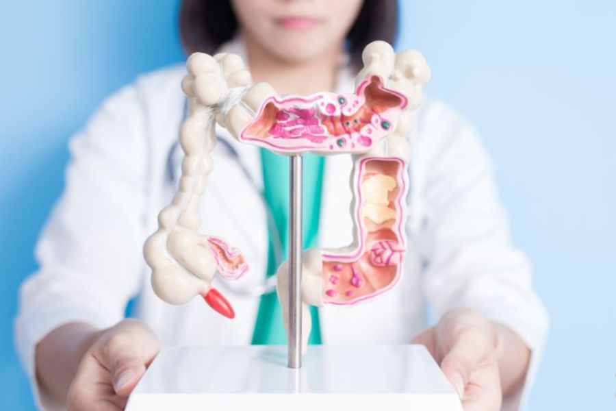 Saúde-Diagnostico-Câncer-de-intestino-saude-bem-estar-e-beleza